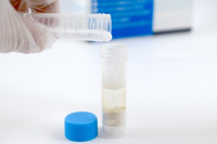 Петритест на Сульфатредуцирующие бактерии (BART тест)