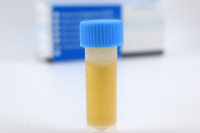 Петритест на Сульфатредуцирующие бактерии (BART тест)